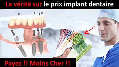 Qu'est-ce qui peut remplacer un implant dentaire