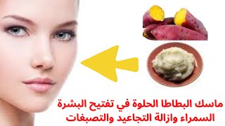 فوائد ماسك البطاطا الحلوة لتبييص البشرة السمراء وازالة التجاعيد والتصبغات الجلدية