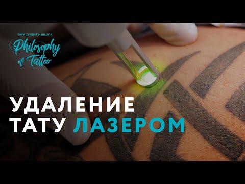 Видео: Как работает удаление татуировки?