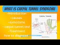 Carpal tunnel syndrome|carpal tunnel syndrome with treatment| carpal tunnel and its exercise
