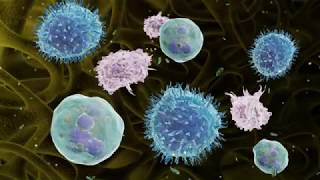 Rheumatoid Arthritis and Interleukin 6 [HD]