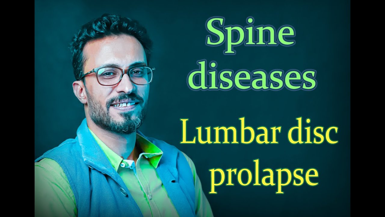 02 Spine diseases: Lumbar disc prolapse