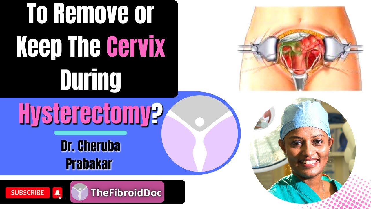To Remove or Keep The Cervix During Hysterectomy? That Is The Question! - TheFibroidDoc