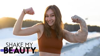 They Called Me 'The Hulk' - Now I've Accepted My Arm | SHAKE MY BEAUTY