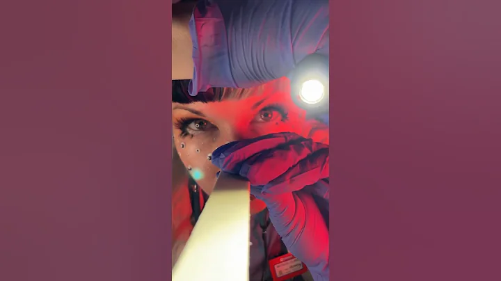 Questionable Doctor Gives You a Lobotomy 🔨 #asmr thumbnail