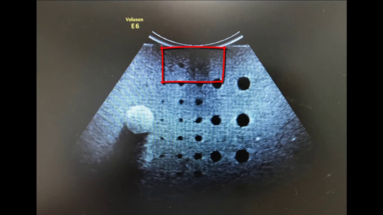 Ultrasound probe repairs Did you know YouTube