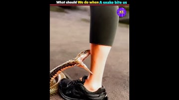 what we should do when a snake bite us#shorts #medical