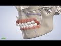 Orthognathic (Corrective Jaw) Surgery in Provo UT: Dr. Harris | Utah Surgical Arts