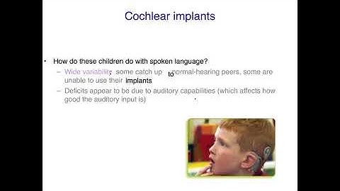 AcqOfLang1: Children With Cochlear Implants