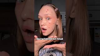 высыпания😱гель против прыщей WW152236#прыщи #высыпания #макияж