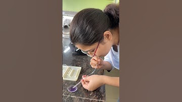 Total WBC (Leucocyte) count TLC with viva questions #physiology #practical  #1styearmbbs #doctor