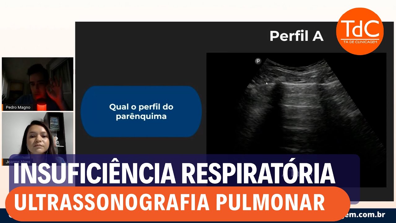 Thumbnail - Padrões de ultrassonografia pulmonar!