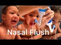 Cleaning Baby’s Runny Nose, Nasal Flush