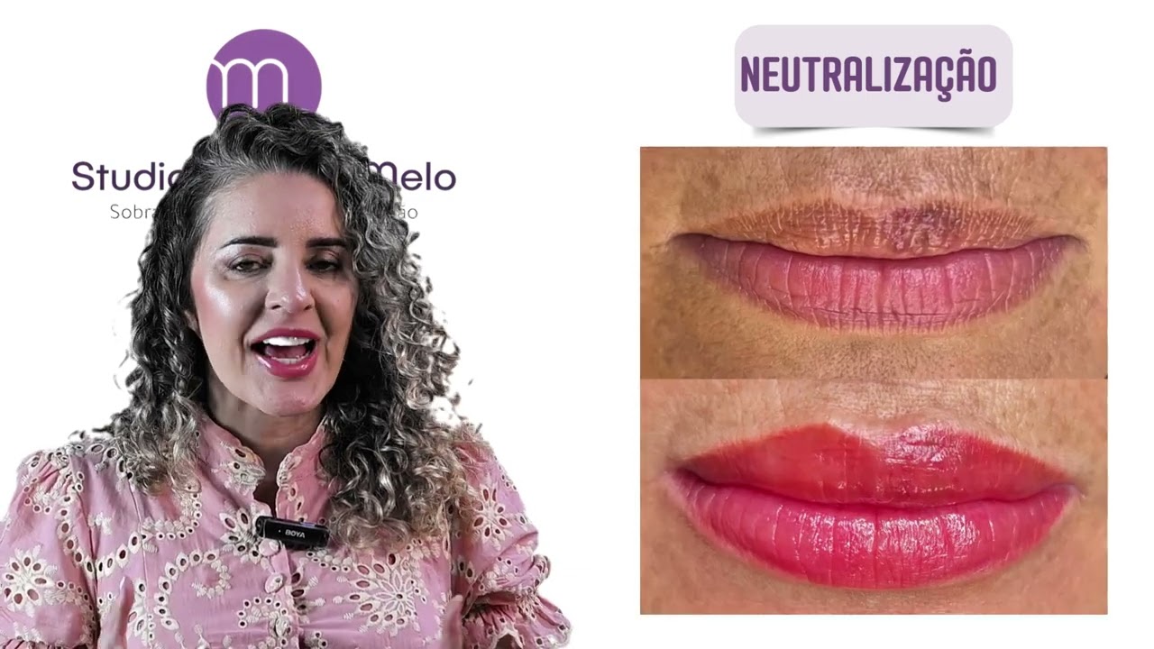 Procedimento Labial - Studio Mônica Melo