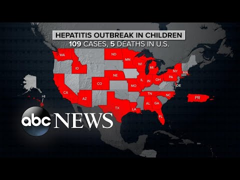 CDC issues new global alert on hepatitis cases in children - ABCNL.