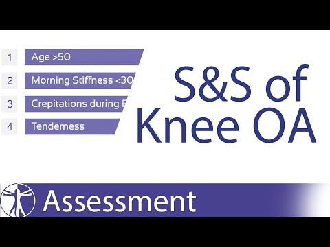 Signs & Symptoms of Knee Osteoarthritis