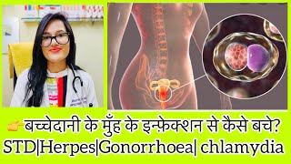 बच्चेदानी के मुँह का इन्फ़ेक्शन?Cervix Infection?Cervicitis Best Homeopathic Medicine?Uterus Mouth ?