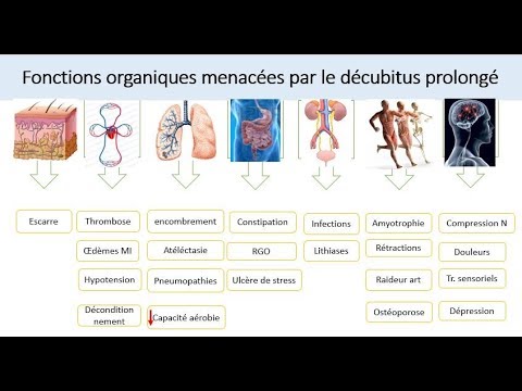 Vidéo: Complications Thromboembolytiques - Quel Est Le Risque? La Prévention