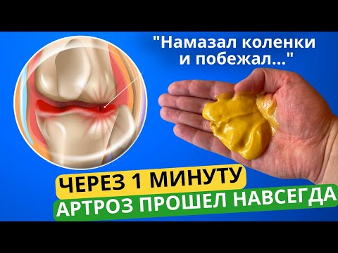 БОЛЬ В КОЛЕНЕ УШЛА ЗА СЧИТАННЫЕ МИНУТЫ. Простое средство от АРТРОЗА