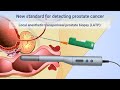 Transperineal Prostate Biopsies Under Local Anesthesia