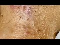 Enjoy Facial Treatment  With Chung Vo Spa New Videos | 140
