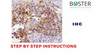 Immunohistochemistry (IHC) | Step by step instructions