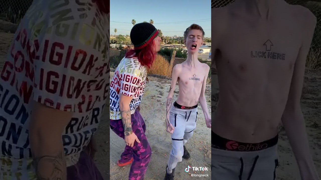 El hombre más flaco del mundo