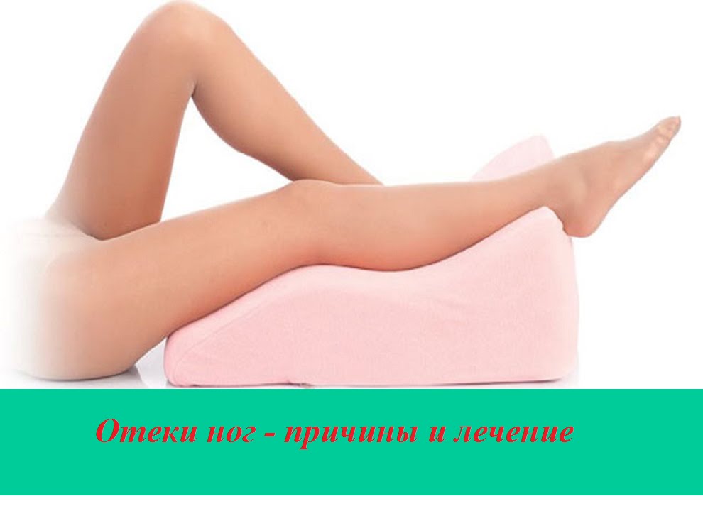 Отеки причины и лечение - YouTube