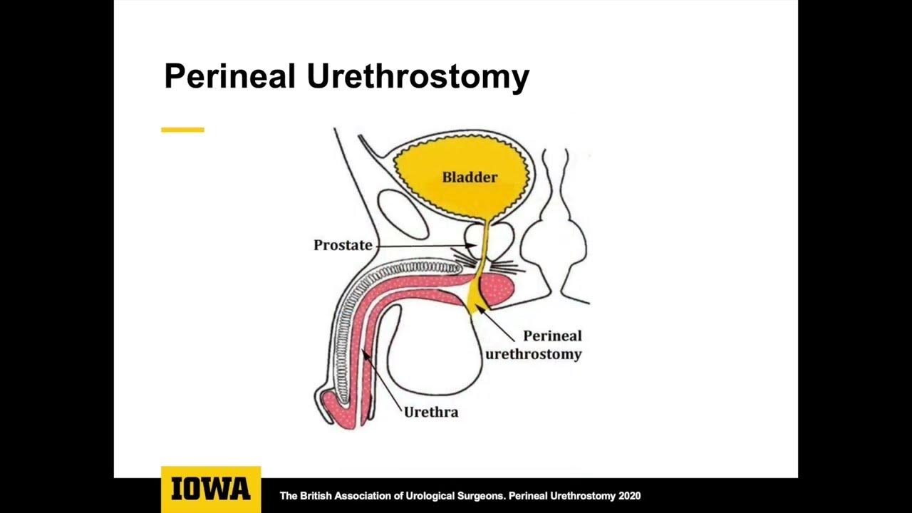 core-videos-2021-perineal-urethrostomy-youtube