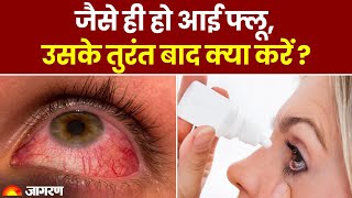 Eye Flu आई फल हन क बद तरत कय कर? Conjunctivitis Interview