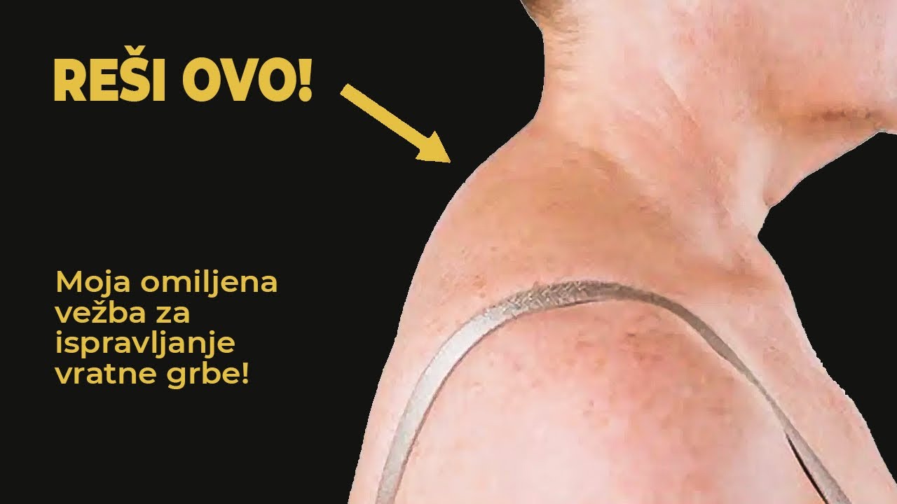 Grba na vratu? Rešite uz ove vežbe i detaljno objašnjenje!