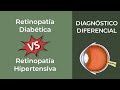 Diagnóstico Diferencial. Retinopatía Diabética vs Retinopatía Hipertensiva
