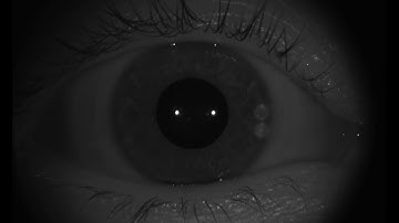 Transfolio Scanner Output for Eye Movement and Dilation reference