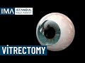 Vitrectomy  istanbul medical assistance