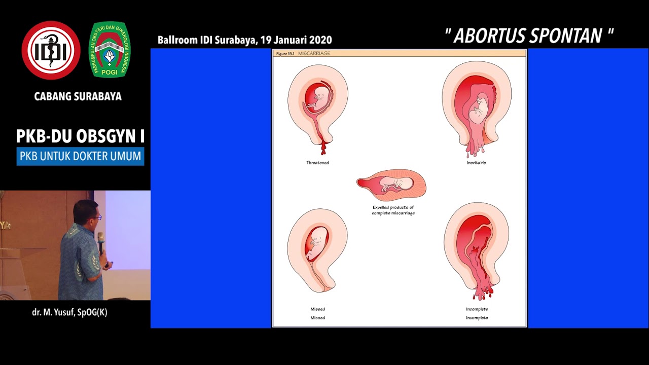 08 Abortus Spontan - dr. M. Yusuf, SpOG(K)