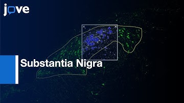 Dopaminergic Neuron Density Determination in Substantia Nigra | Protocol Preview