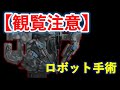 ダヴィンチ手術　実際の映像　ダビンチ　腹腔鏡　がん治療【医師解説】