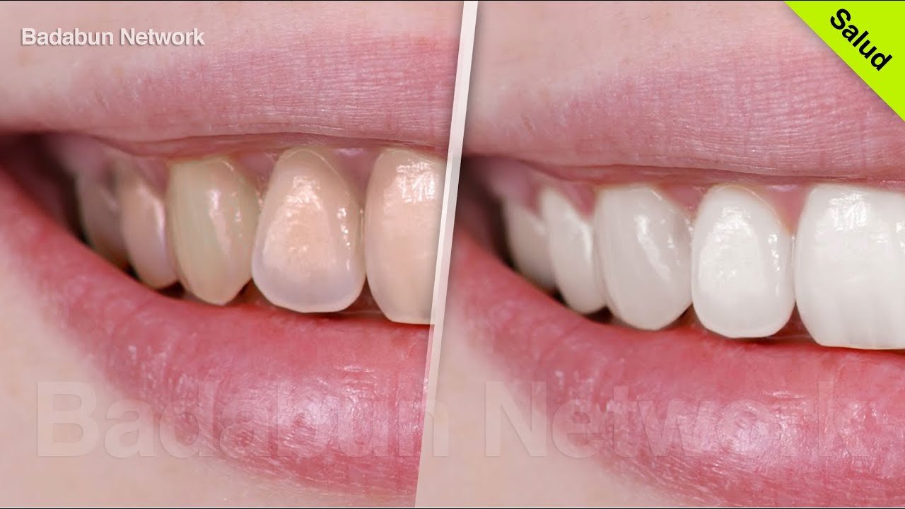 Mira La Forma Correcta De Cepillar Tus Dientes Y Tenerlos Blancos