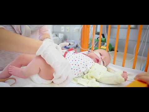 Video: Zwerchfellhernie - Symptome, Behandlung Bei Neugeborenen Und Kindern