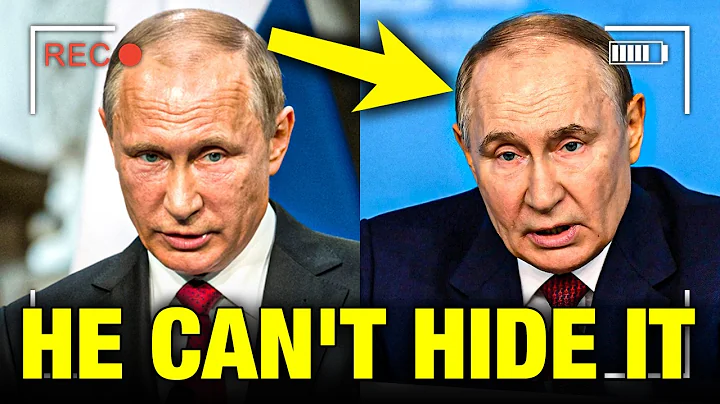 Putin’s FATAL SECRET gets PUBLICLY exposed FINALLY!!