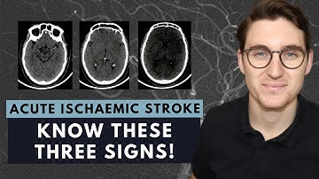 How to read a CT brain scan: Acute ischaemic stroke for beginners