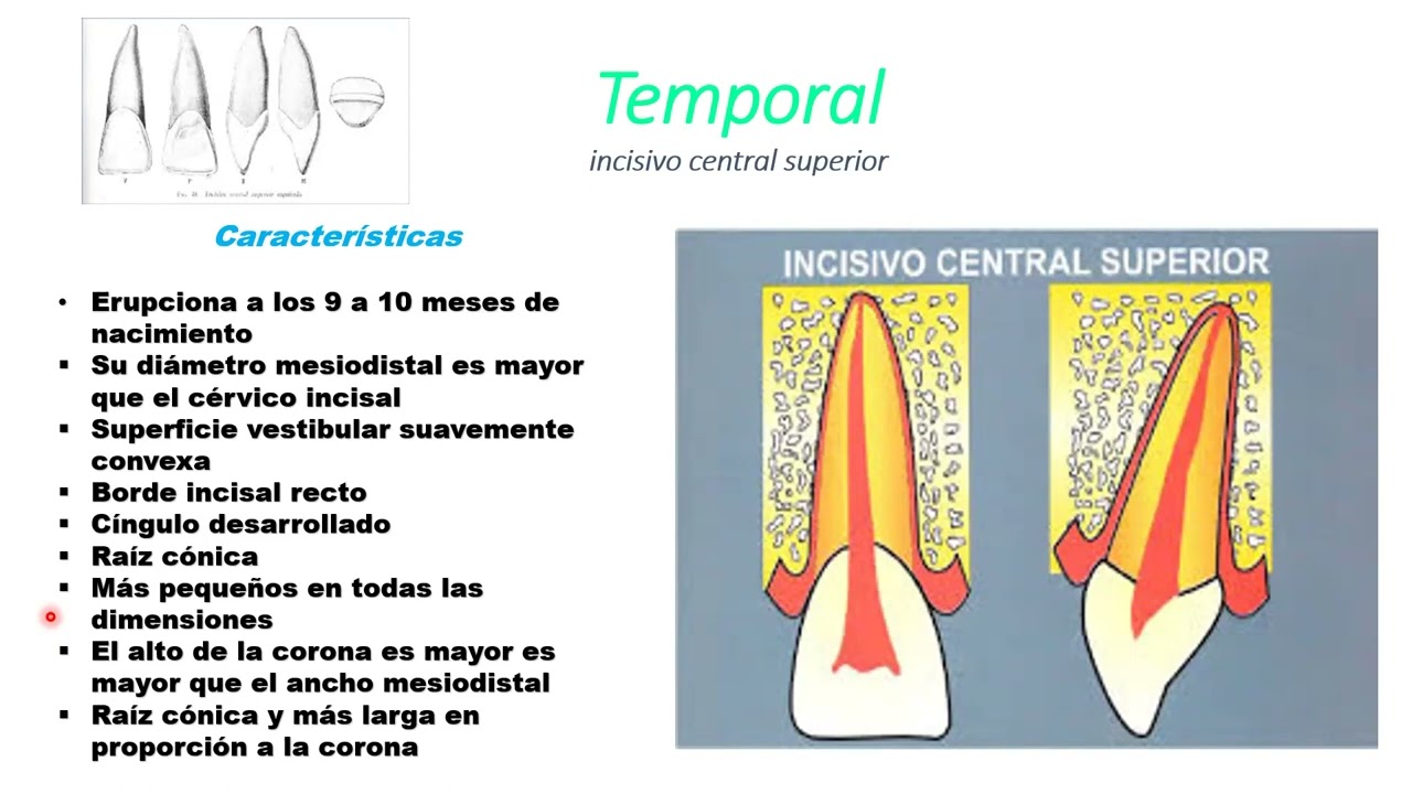 INCISIVO CENTRAL SUPERIOR PERMANENTE, INCISIVO LATERAL SUPERIOR PERMANENTE.