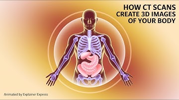 How CT Scans Create 3D Images of Your Body - Animated by Explainer Express