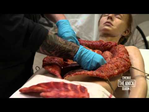 The Knick Season 2: Body Shop  Heroin Addict Autopsy (Cinemax)