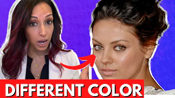 ¿Tiene Mila Kunis los ojos de otro color?