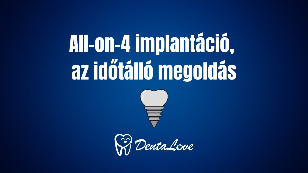All-on-4 implantáció