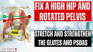 How To Correct a High Hip and Rotated Pelvis