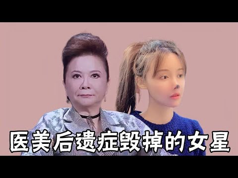 被医美后遗症毁掉的女星，蔡明又肿又僵，看到闫妮：不敢认
