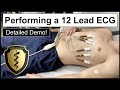 12 lead ecg placement example  how to perform a 12 lead