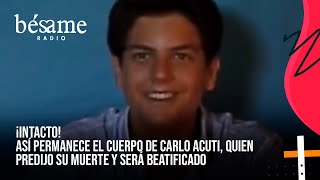Así Permanece El Cuerpo De Carlo Acutis, El Joven Que Será Beatificado